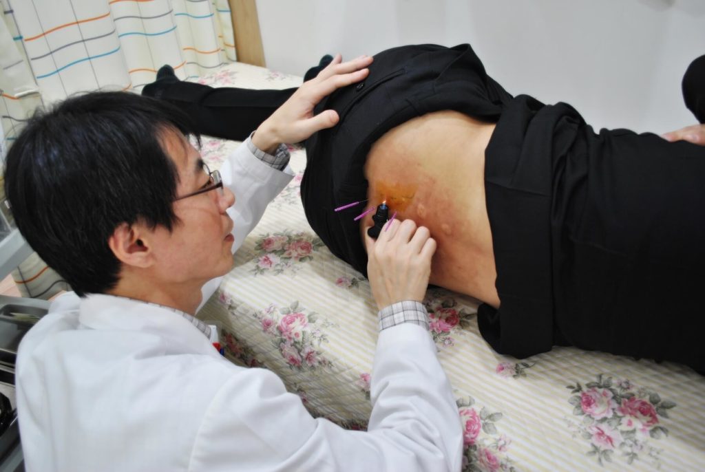 황태현 원장 아피톡신 봉독 시술 이미지